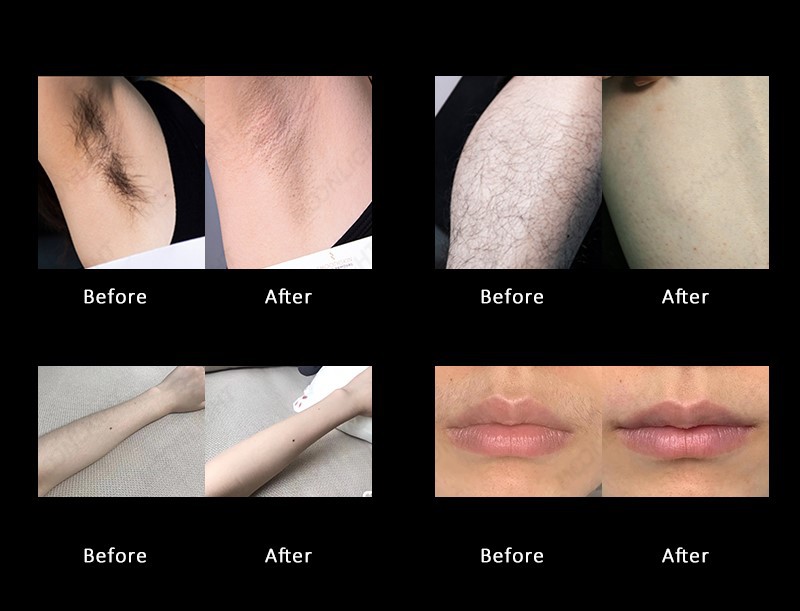 moonlight-09 moonlight-09