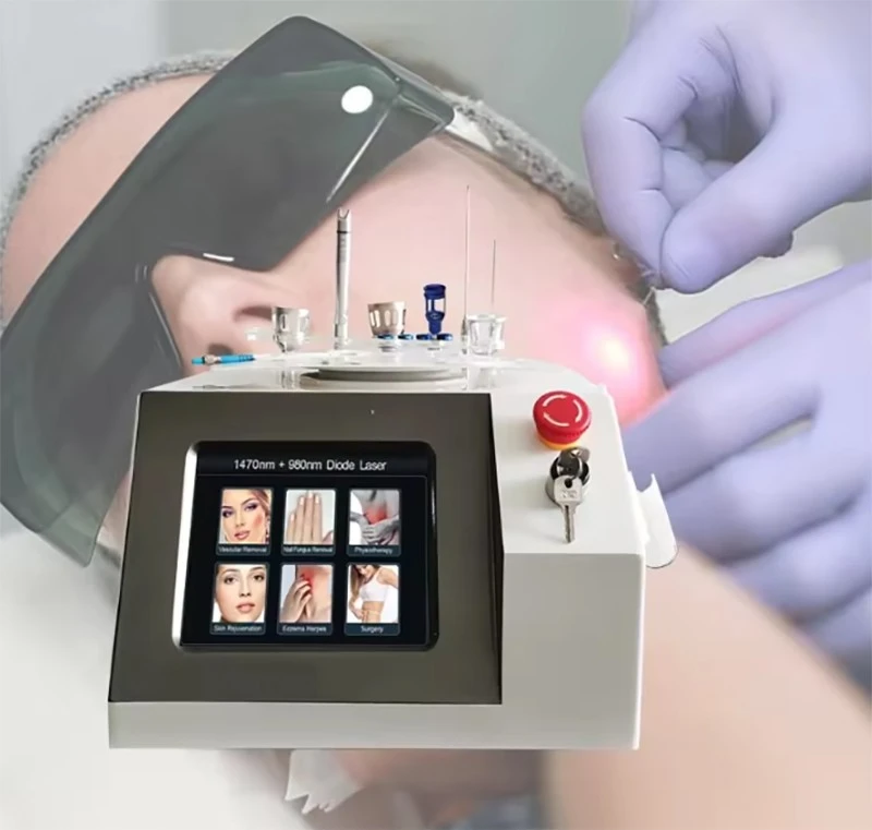 Dual 980nm & 1470nm Diode Laser Machine