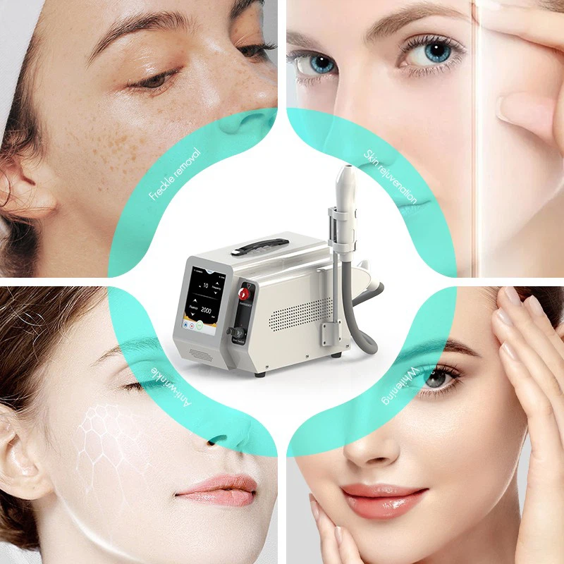 Portable Tattoo Removal Machine