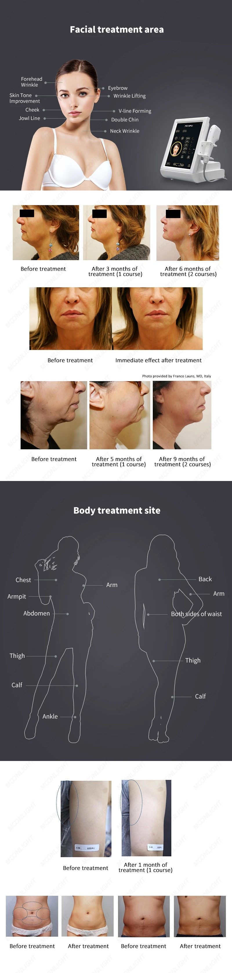 Facial-effects001
