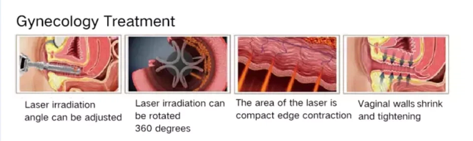 Professional CO2 Laser Machine manufacturers